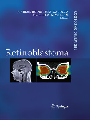 cover image of Retinoblastoma